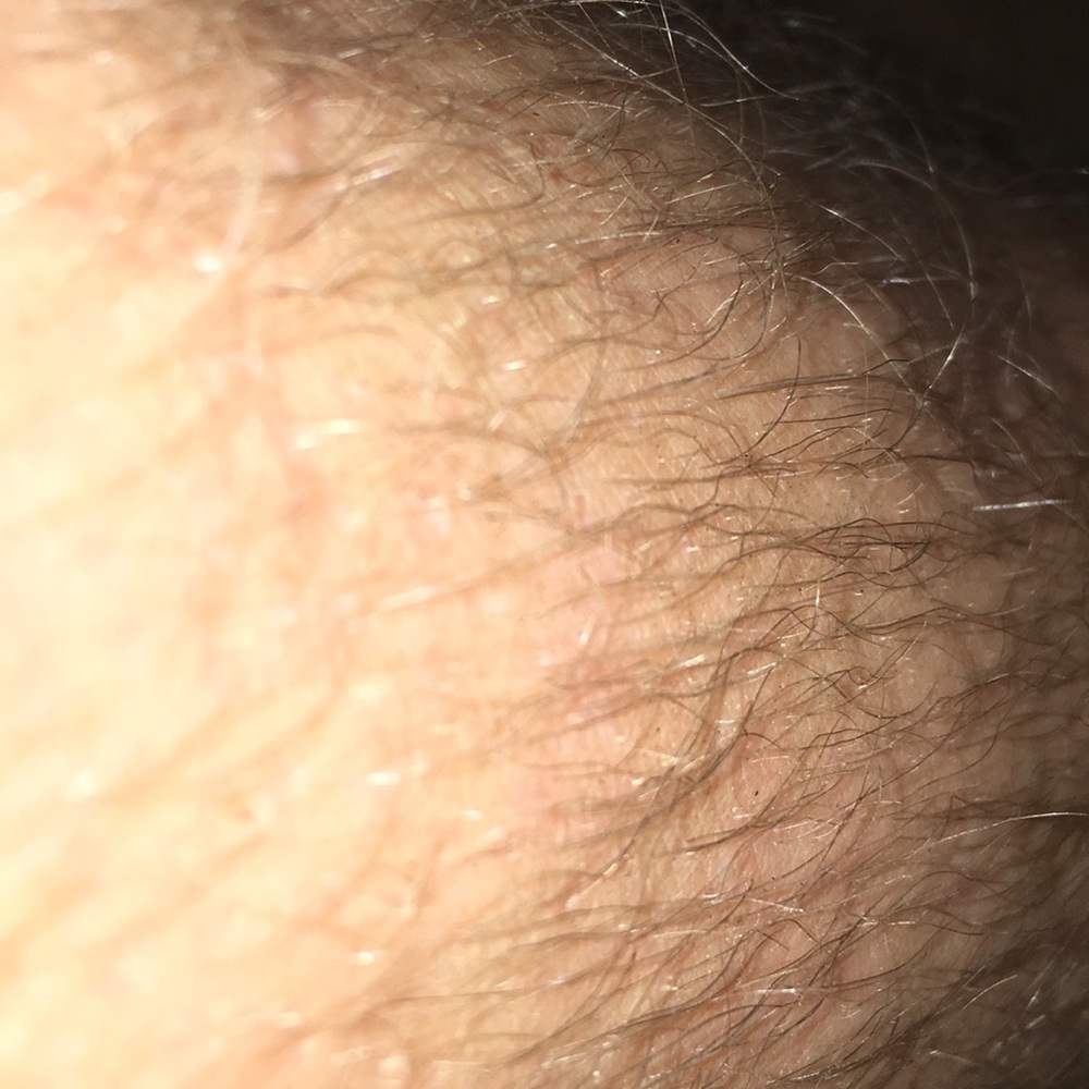 My leg hair